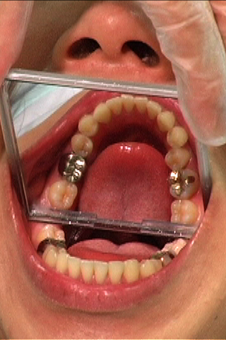 歯科衛生士の口内観察わいせつ