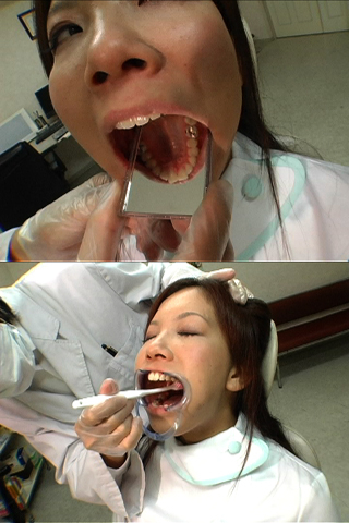 歯科衛生士の口内観察わいせつ