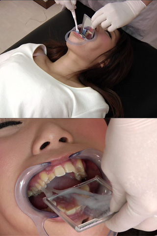 【八重歯】美少女の八重歯を歯磨きハイビジョン！！