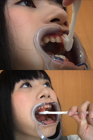 神谷つくし◆磨き残し＆インレー歯周病◆SD&高画質(1280x720)