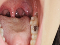 フェチ：歯とのどちんこ　写真集(画像データ)