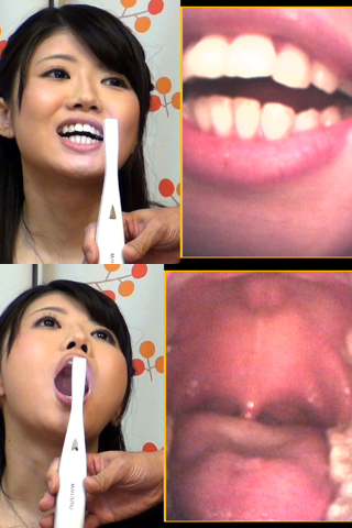 1日4回歯磨きする子の歯観察