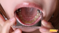 フェチ：「歯とのどちんこ２０人③」データ写真集