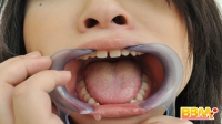 フェチ：「歯とのどちんこ２０人④」データ写真集