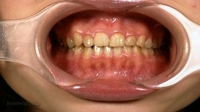 フェチ：歯の観察　ほのかサン篇