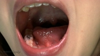 歯と喉ちんこ「口内観察」データ写真９枚つき