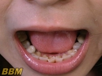 フェチ：美女の歯とのどちんこ