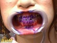フェチ：美女の歯 観察映像